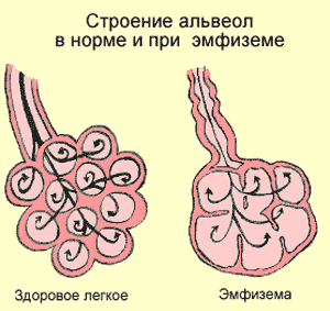 альвеолы